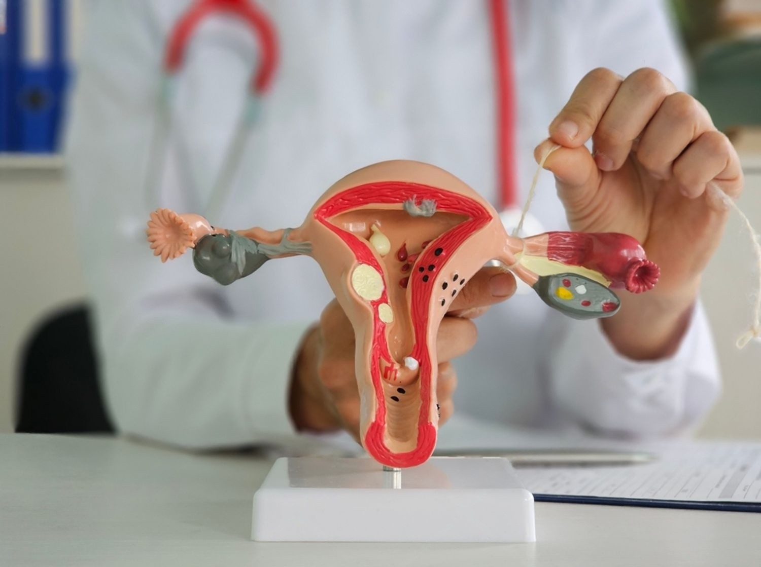General Gynecology